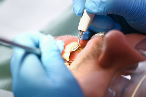 Best Broken Tooth Emergency  in Kankakee, IL