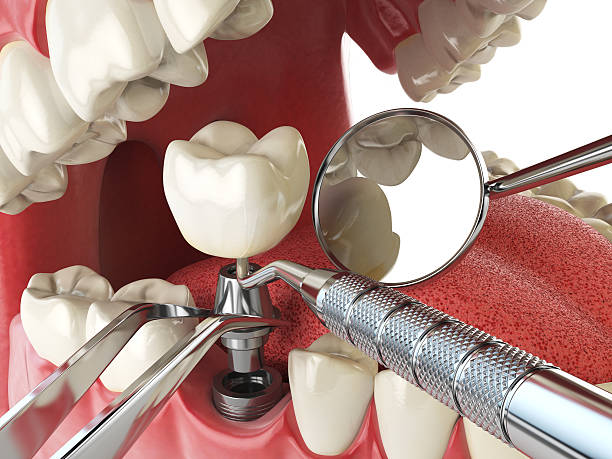 Best Urgent Tooth Repair  in Kankakee, IL